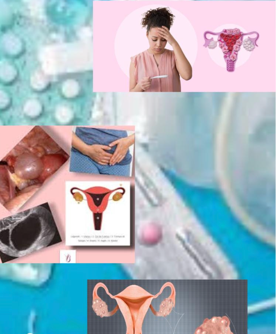 Lire la suite à propos de l’article Contraception et santé reproductive : démystifions les idées reçues